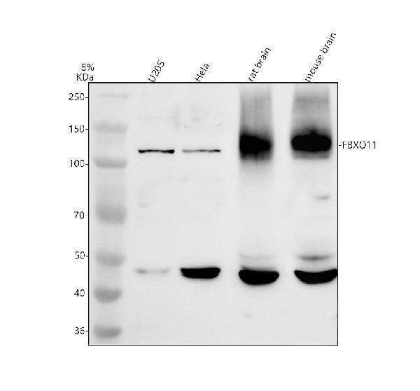 Western blot analysis of FBXO11 using anti-FBXO11 antibody (A04708-1)