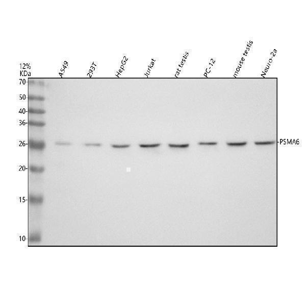  Western blot analysis of PSMA6 using anti-PSMA6 antibody (A04710-1)