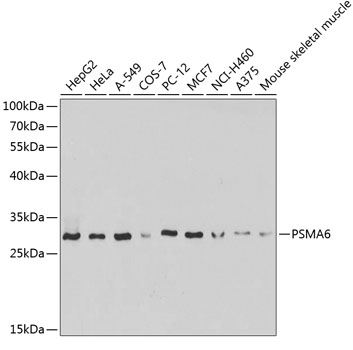 a04710 psma6 primary antiboties wb testing 1