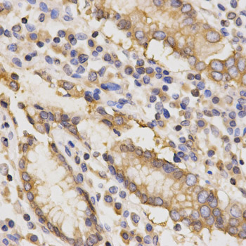 Immunofluorescence analysis of HeLa cells using TAPBP antibody 
