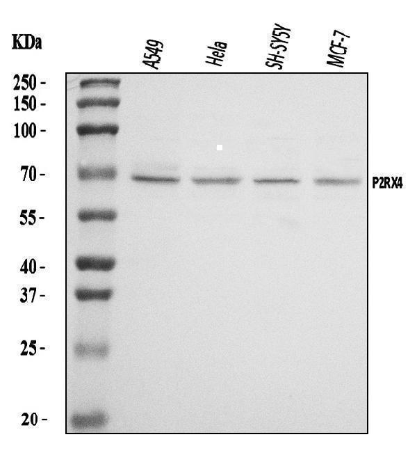  Western blot analysis of P2X4/P2RX4 using anti-P2X4/P2RX4 antibody (A04715-2)