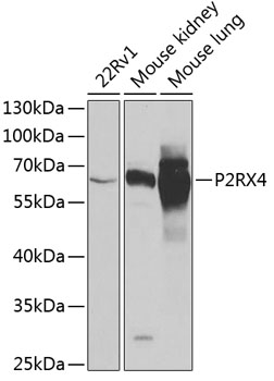 Western blot analysis of extracts of various cell lines, using P2RX4 antibody  at 1:1000 dilution