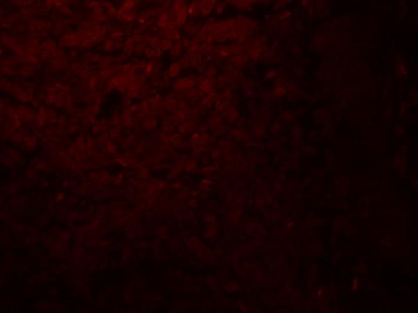 a04718 slc29a2 primary antibodies if testing 3