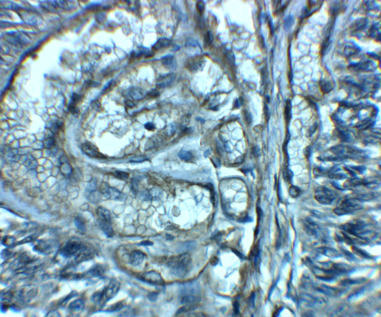 a04718 slc29a2 primary antibodies ihc testing 2