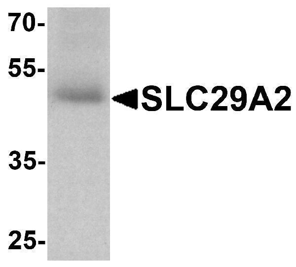 a04718 slc29a2 primary antibodies wb testing 1