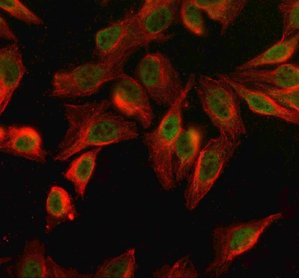  IF analysis of SPO11 using anti-SPO11 antibody (A04719-3) and anti-Beta Tubulin antibody (M01857-3)
