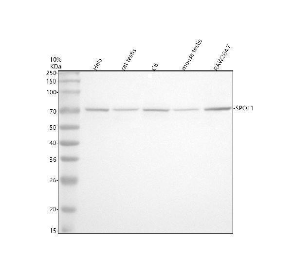  Western blot analysis of SPO11 using anti-SPO11 antibody (A04719-3)