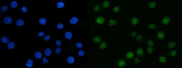 a04722 1 csnk2k2 primary antibodies if testing 12