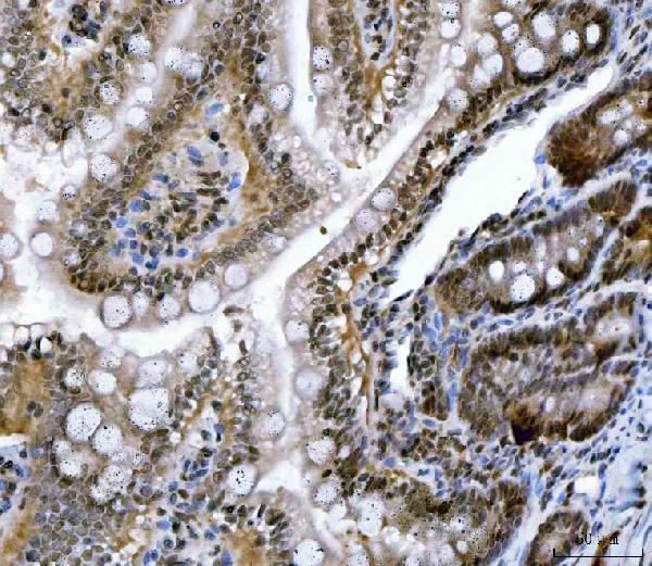 a04722 1 csnk2k2 primary antibodies ihc testing 10