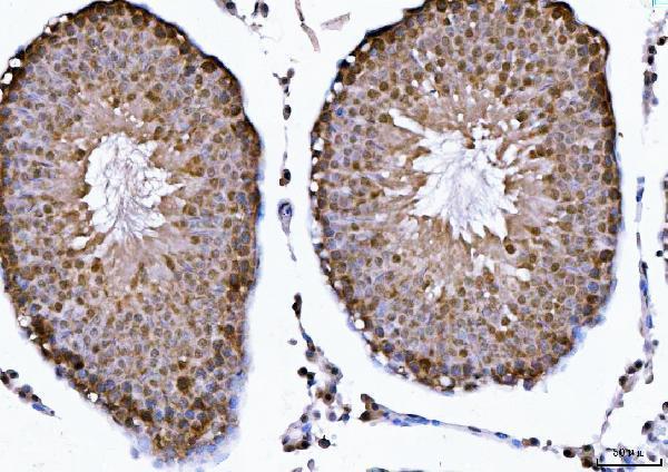 a04722 1 csnk2k2 primary antibodies ihc testing 11_1
