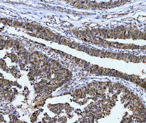 a04722 1 csnk2k2 primary antibodies ihc testing 2_1