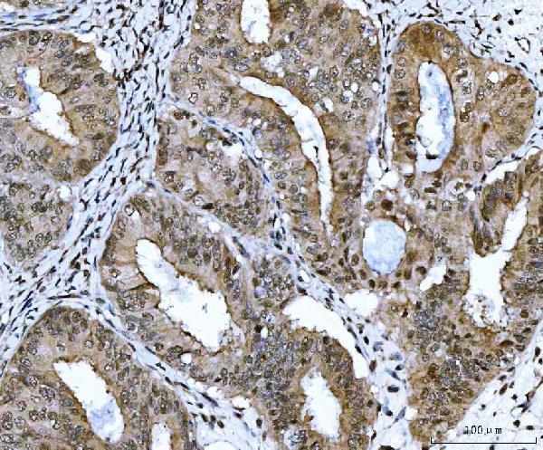 a04722 1 csnk2k2 primary antibodies ihc testing 3_1