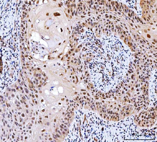 a04722 1 csnk2k2 primary antibodies ihc testing 4