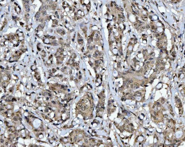 a04722 1 csnk2k2 primary antibodies ihc testing 5