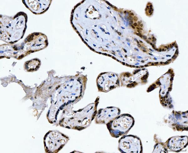 a04722 1 csnk2k2 primary antibodies ihc testing 6