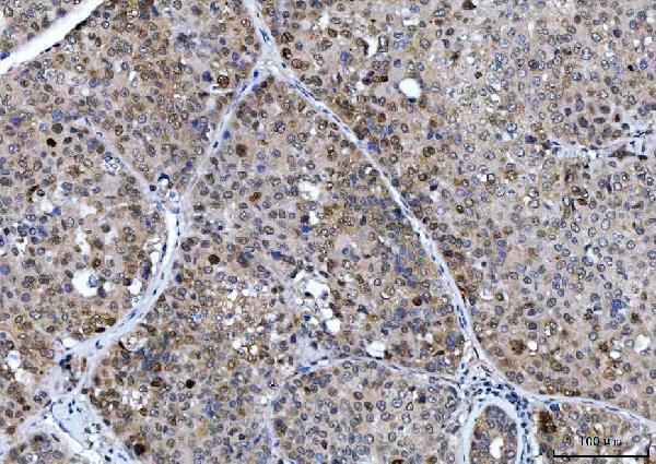 a04722 1 csnk2k2 primary antibodies ihc testing 7