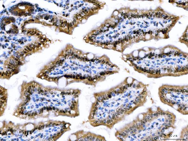 a04722 1 csnk2k2 primary antibodies ihc testing 8