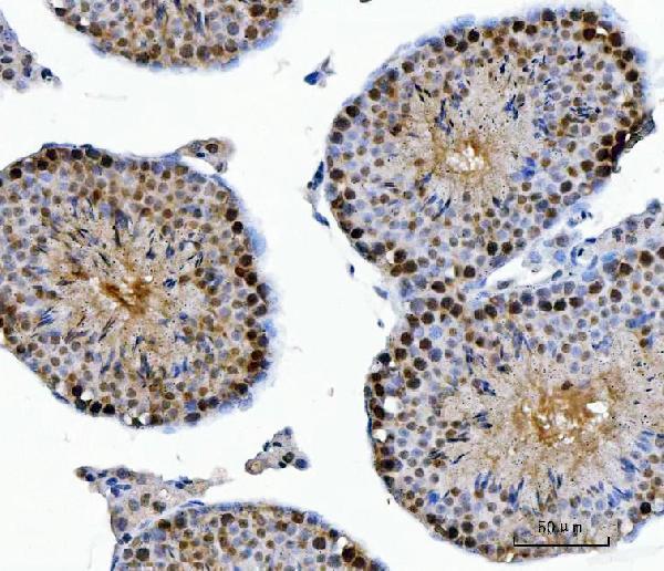 a04722 1 csnk2k2 primary antibodies ihc testing 9