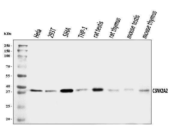 a04722 1 csnk2k2 primary antibodies wb testing 1
