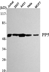 Western Blot analysis using PP5 Monoclonal Antibody against HeLa, Jurkat, 293T, A431, MCF7 cell lysate