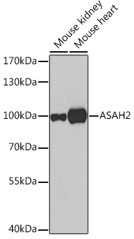 Western blot analysis of extracts of various cell lines, using ASAH2 Rabbit pAb  at 1:500 dilution