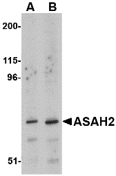 Western blot analysis of ASAH2 in 293 cell lysate with ASAH2 antibody at (A) 1 and (B) 2 μg/mL