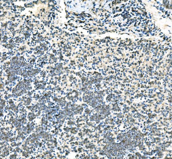 a04728 1 ube2d primary antibodies ihc testing 2