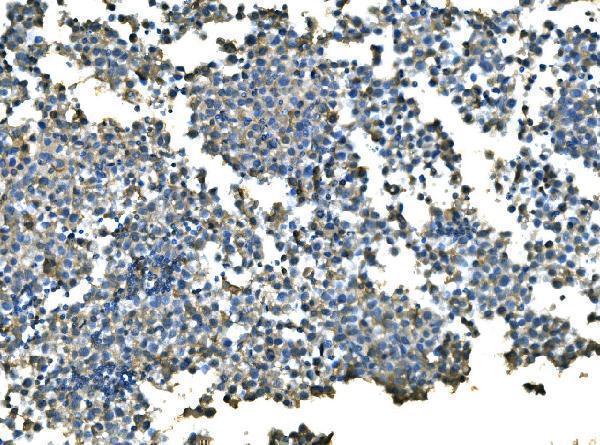 a04728 1 ube2d primary antibodies ihc testing 3