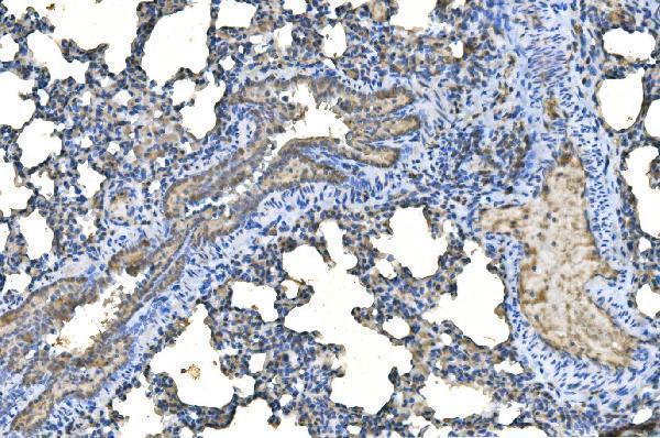 a04728 1 ube2d primary antibodies ihc testing 5