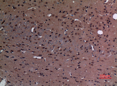 a04729 1 stmn2 primary antibodyes ihc testing 2