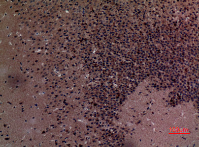 a04729 1 stmn2 primary antibodyes ihc testing 4