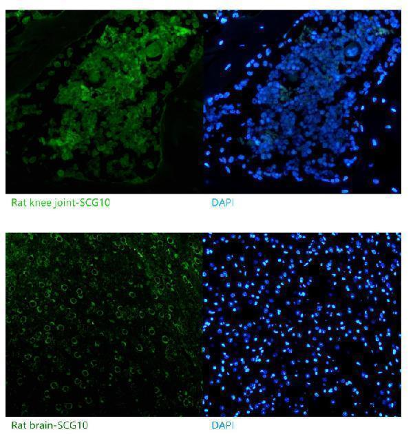 a04729 2 stmn2 primary antibodies if testing 1