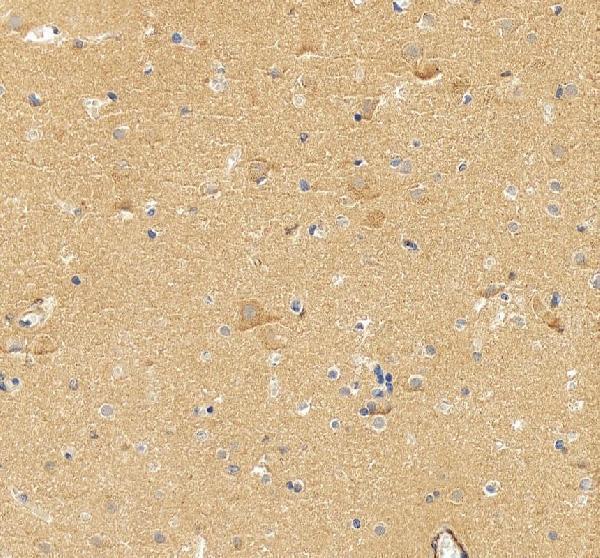 a04729 2 stmn2 primary antibodies ihc testing 4_1
