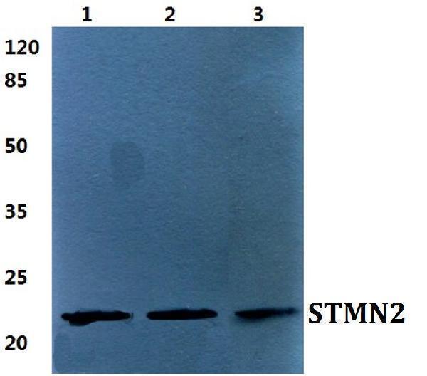 a04729 stmn2 primary antiboties wb testing 1