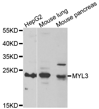 WesternBlot (WB) analysis of MYL3 polyclonal antibody