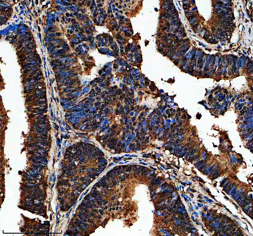 IHC analysis of MACC1 using anti-MACC1 antibody (A04732-1)