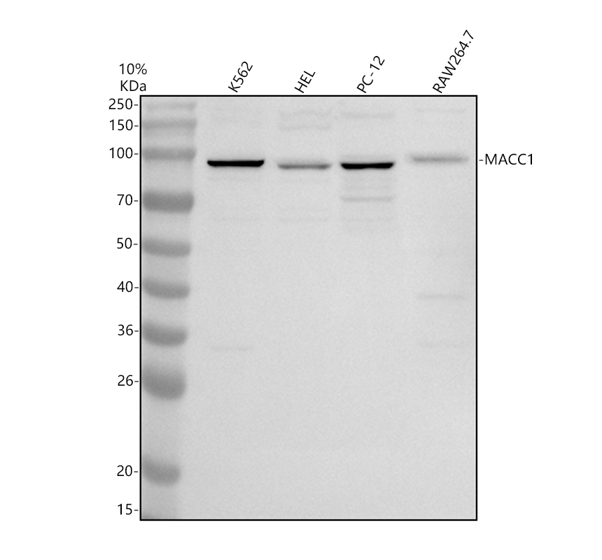 Western blot analysis of MACC1 using anti-MACC1 antibody (A04732-1)