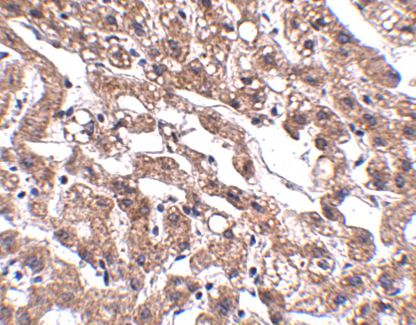 a04732 macc1 primary antibodies ihc testing 2