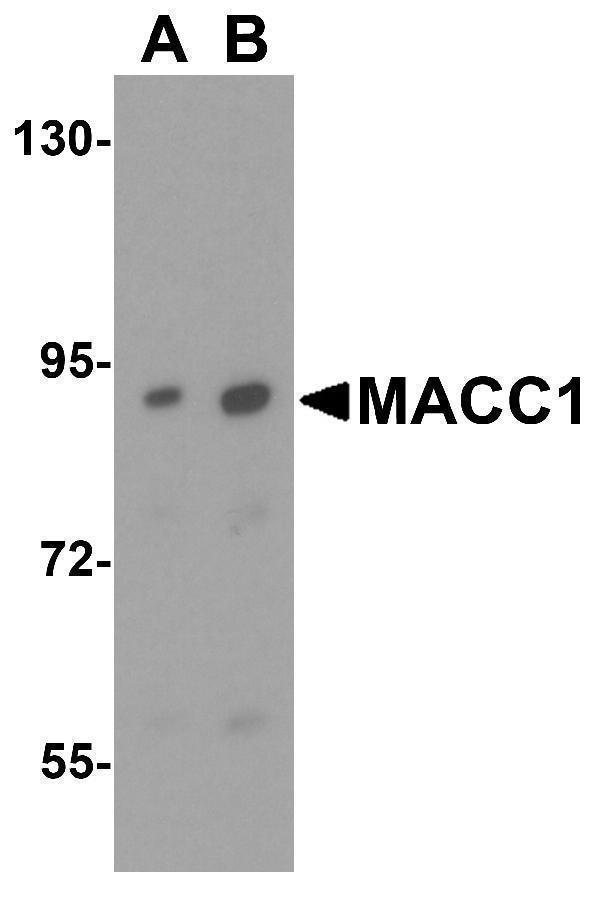 a04732 macc1 primary antibodies wb testing 4