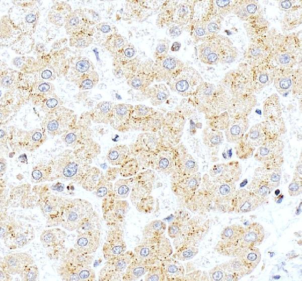 IHC analysis of MTF1 using anti-MTF1 antibody (A04733-2)