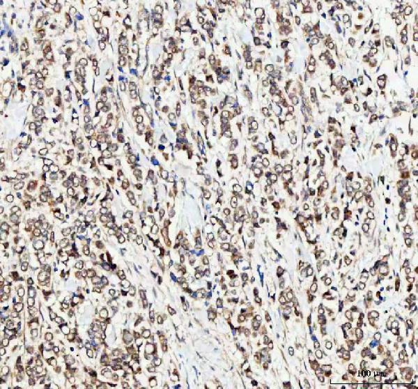  IHC analysis of MTF1 using anti-MTF1 antibody (A04733-3)
