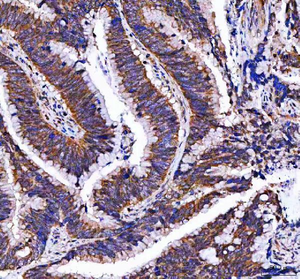  IHC analysis of MTF1 using anti-MTF1 antibody (A04733-3)