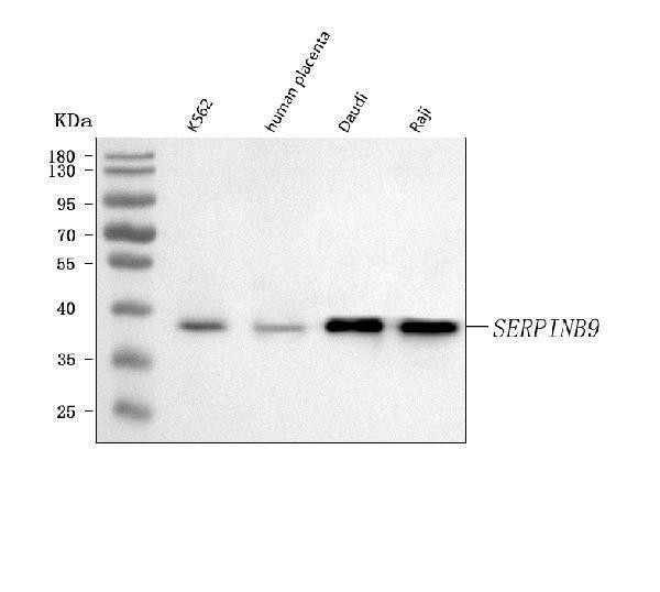  Western blot analysis of SERPINB9 using anti-SERPINB9 antibody (A04734-1)
