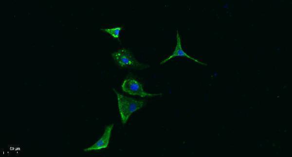 a04734 serpinb9 primary antibodies if testing 1