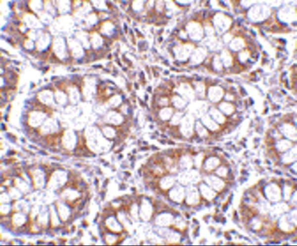 a04735 cd248 primary antibodies ihc testing 4