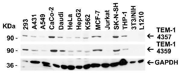 a04735 cd248 primary antibodies wb testing 2