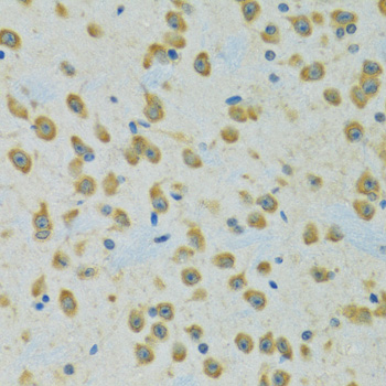 Immunohistochemistry of paraffin-embedded rat brain using RPS7 antibody  at dilution of 1:100 