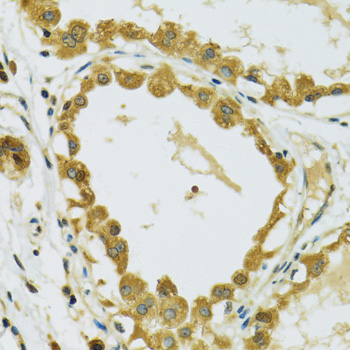 Immunohistochemistry of paraffin-embedded human breast using RPS7 antibody  at dilution of 1:100 