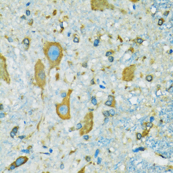 a04736 rps7 primary antiboties ihc testing 4
