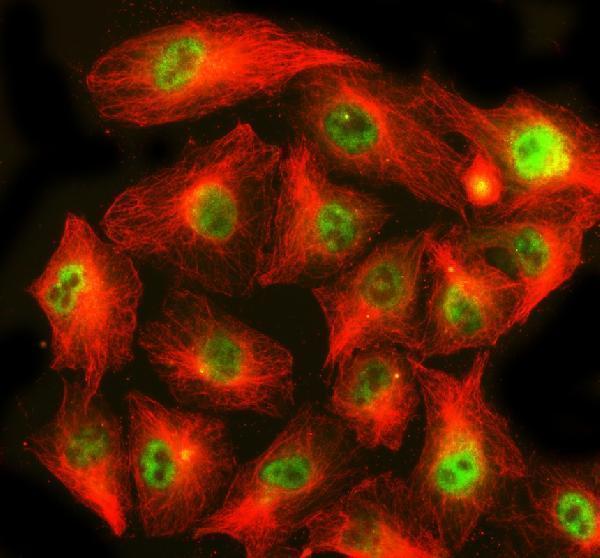 IF analysis of CHP1 using anti-CHP1 antibody (A04737-3) and anti-Beta Tubulin antibody (M01857-3)